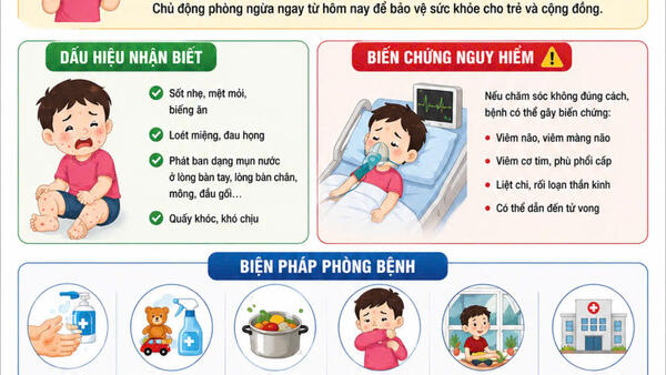 Tăng cường phòng, chống bệnh tay chân miệng trước thềm năm học mới